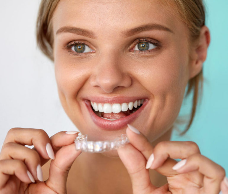 clean-invisalign-1080x675
